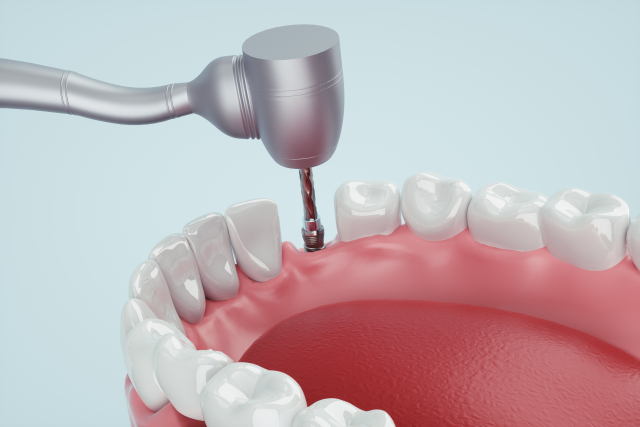 術後の感染リスク